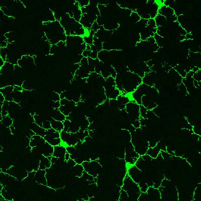 The PLX dataset: what is the role of microglia in dementia risk?